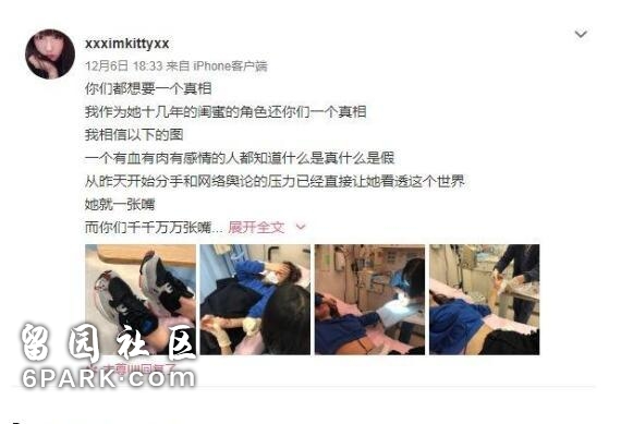 Naomi不堪舆论压力割腕，因丑闻曝光，竟跟陈冠希有过一腿？